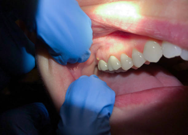 Best Cosmetic Emergency Dentistry in Seth Ward, TX