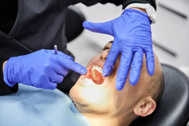 Best Urgent Care for Lost Fillings or Crowns in Seth Ward, TX