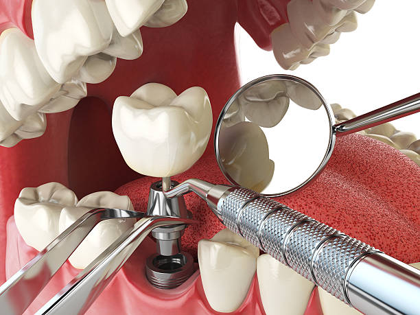 Best Emergency Denture Repair in Seth Ward, TX